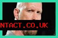 Unveiling The Truth: Steve Austin's Baldness Decoded